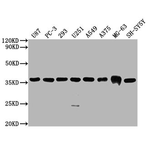 GAPDH?Monoclonal?Antibody