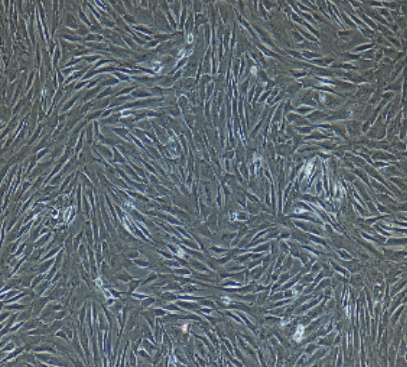 小鼠肺大動脈外膜成纖維細胞