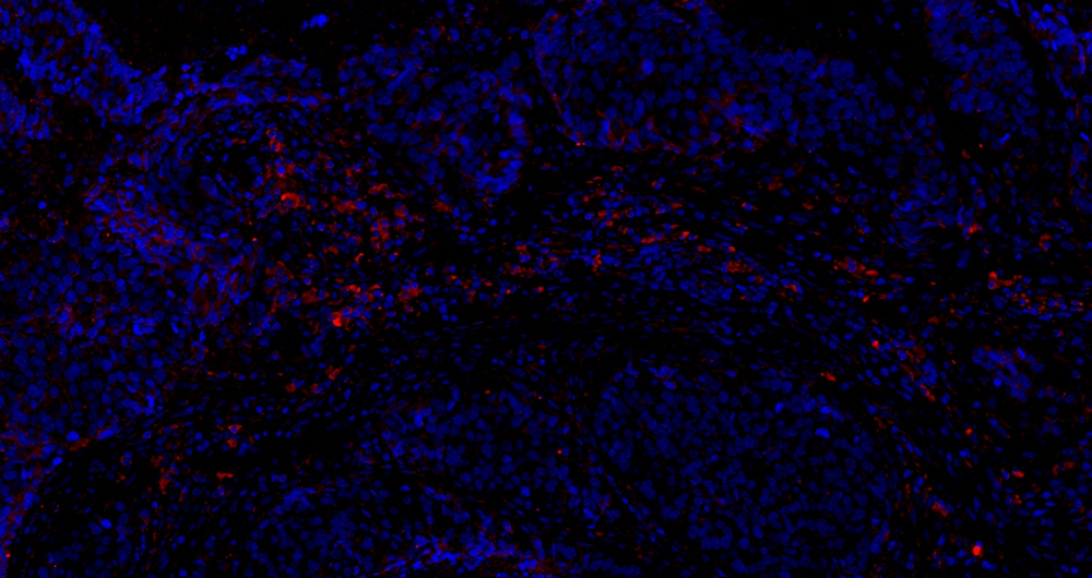 Anti -CD8 beta Rabbit pAb