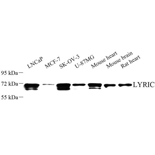 Anti -LYRIC/AEG1 Rabbit pAb