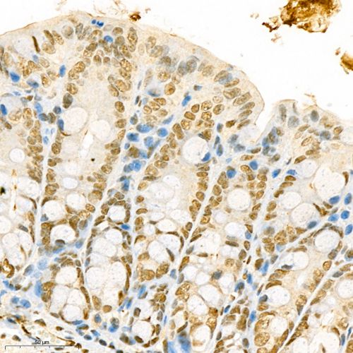 Anti -Neurofibromin Rabbit pAb