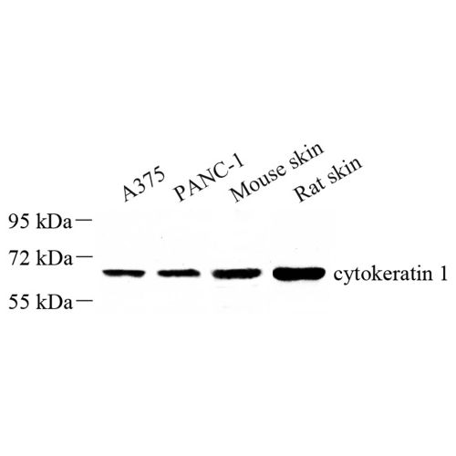 Anti -Cytokeratin 1 Rabbit pAb