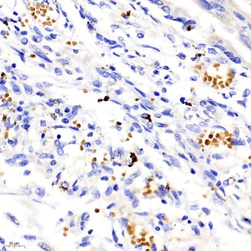 Anti -COX2 / Cyclooxygenase 2 Rabbit pAb