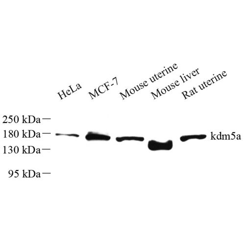 Anti -KDM5A / Jarid1A / RBBP2 Rabbit pAb